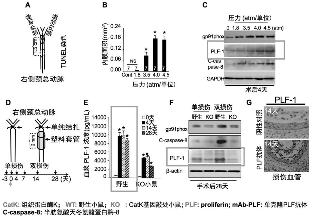 關于PCI術后血管損傷-再狹窄程度的標記物